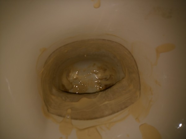 トイレ　掃除　尿石