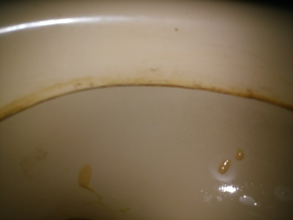 トイレ　掃除　尿石